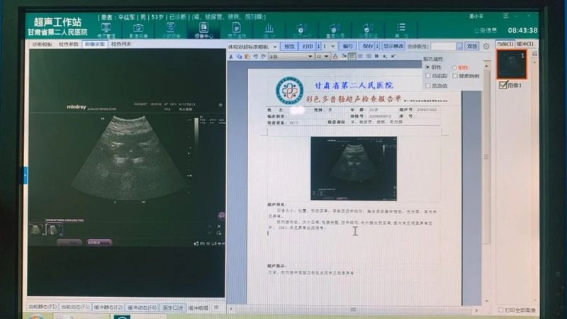 公务员体检不合格补救方法
